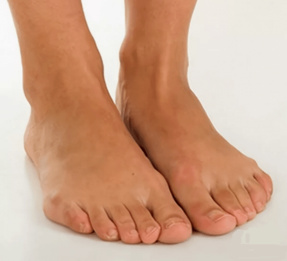 Healthy feet after treatment with Hondrox spray