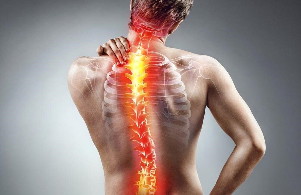 Pain in the spine osteochondrosis