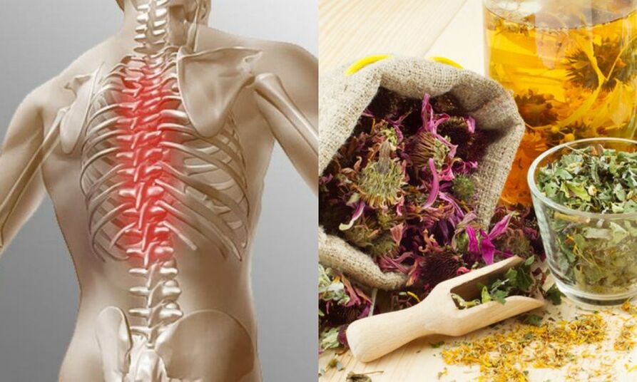 Traditional recipes - prevent the development of osteochondrosis and support spine health