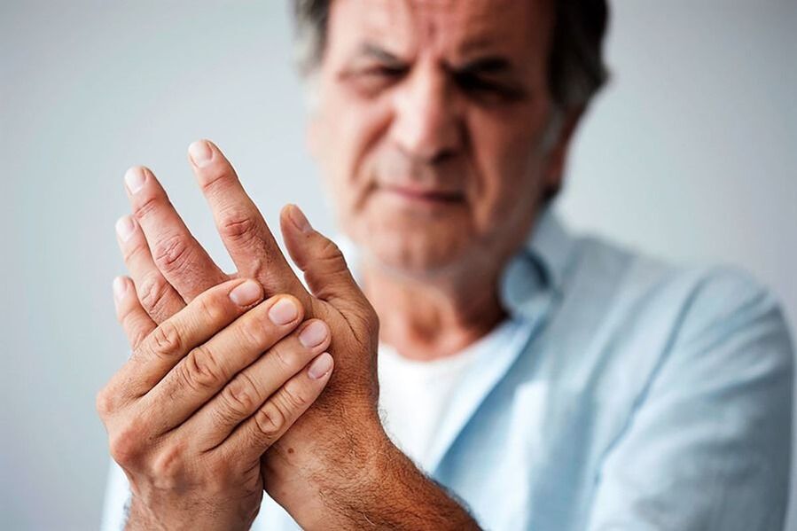 symptoms of hand arthrosis