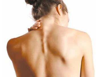 Cervical osteocondrosis - a serious disease