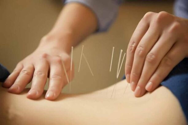 treatment of osteochondrosis with acupuncture